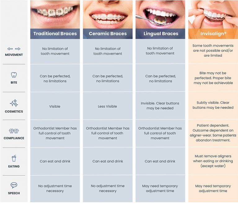 How Much Does Invisalign Express Cost for Only Upper Teeth 